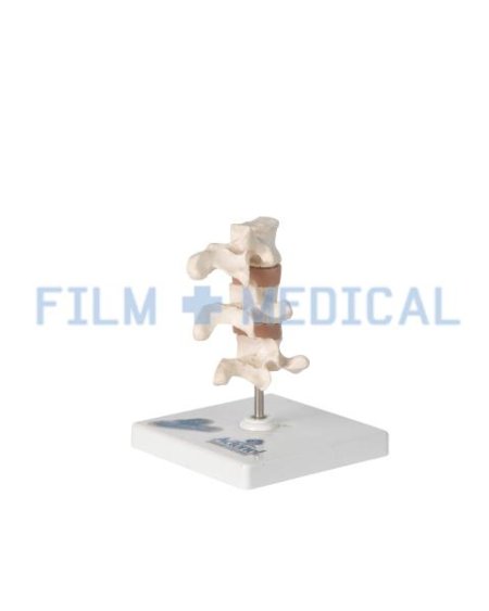 Anatomical Model of the Spine